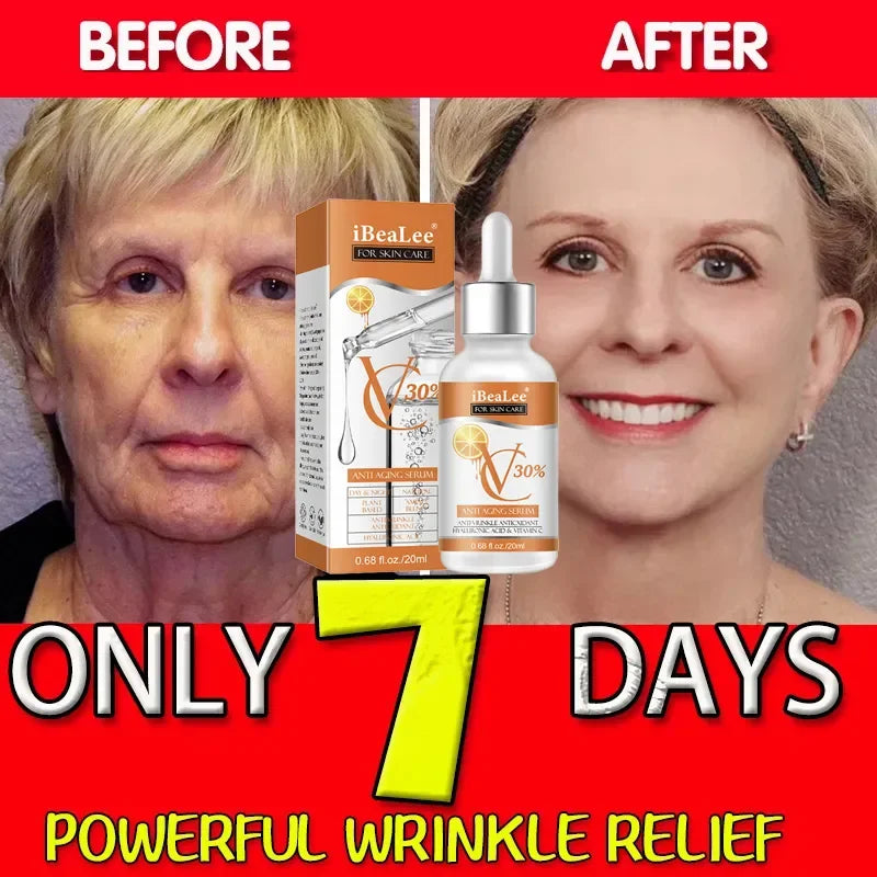 Premium 30% Vitamin C Serum For Face Anti Aging Wrinkle Facial Hyaluronic Acid Retinol Acids Boost Collagen Hydrate Skin Care by Reinvent Yourself