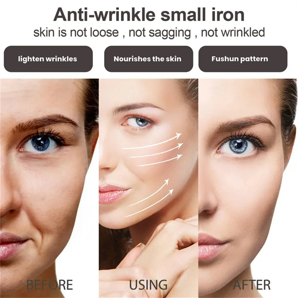 Premium 30% Vitamin C Serum For Face Anti Aging Wrinkle Facial Hyaluronic Acid Retinol Acids Boost Collagen Hydrate Skin Care by Reinvent Yourself