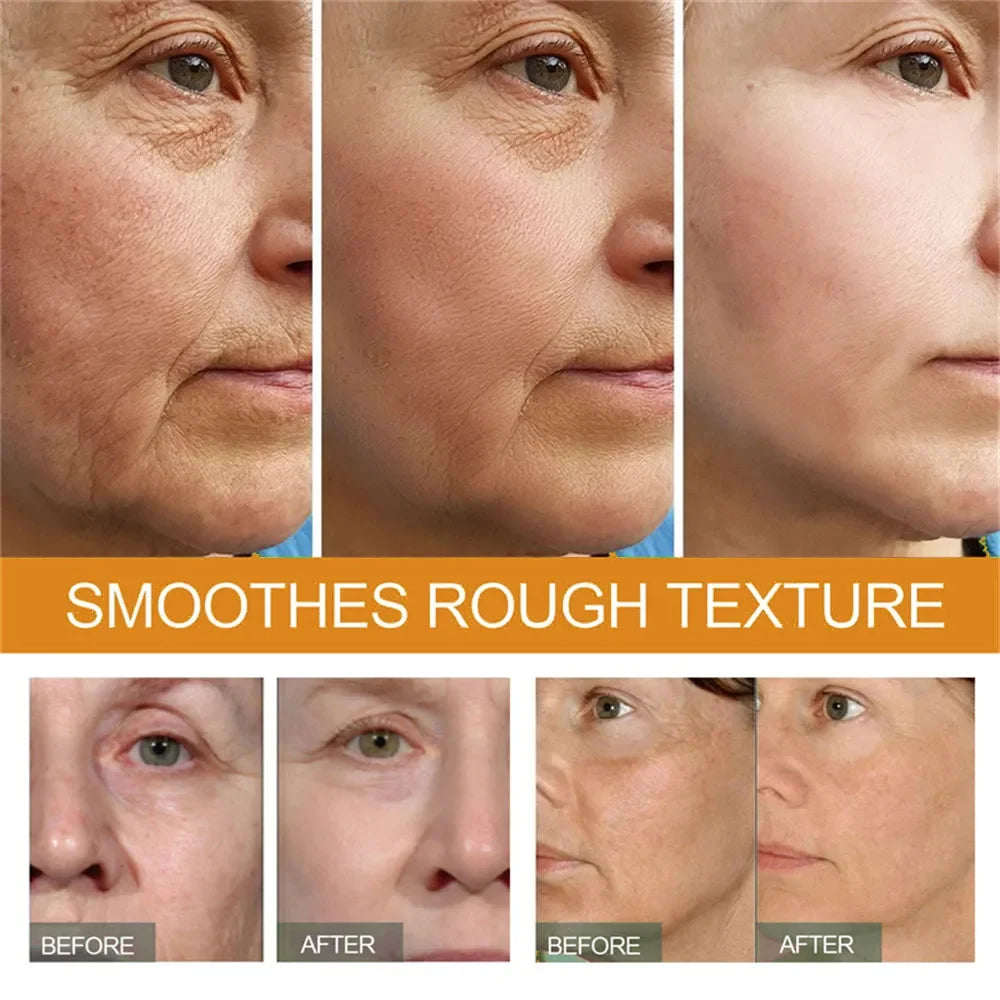 Premium 30% Vitamin C Serum For Face Anti Aging Wrinkle Facial Hyaluronic Acid Retinol Acids Boost Collagen Hydrate Skin Care by Reinvent Yourself