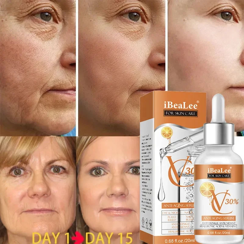 Premium 30% Vitamin C Serum For Face Anti Aging Wrinkle Facial Hyaluronic Acid Retinol Acids Boost Collagen Hydrate Skin Care by Reinvent Yourself